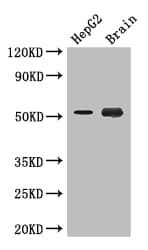 Polyclonal Rabbit anti-Human DAPK3 / ZIP Kinase Antibody (IF, WB)