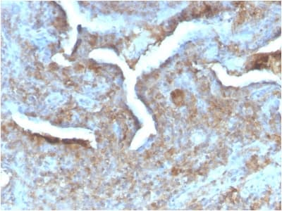 TP / Thymidine Phosphorylase Antibody (clone TYMP/2890R, Azide-free, Carrier-free)