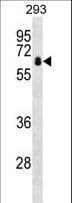 ZBTB7B / HcKrox Antibody (aa315-343)
