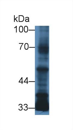 TGFB3 / TGF Beta3 Antibody