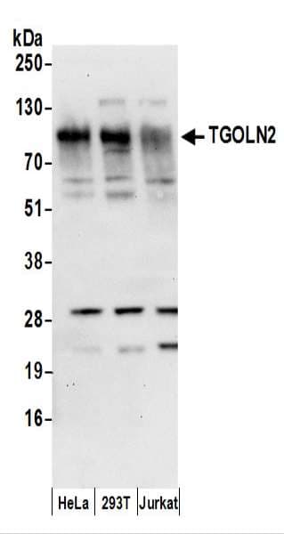 Polyclonal Rabbit anti-Human TGN46 / TGN38 Antibody (aa25-75, IHC, WB)