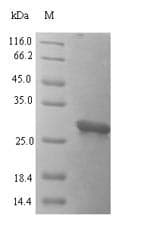 Human FAM150A Protein (Recombinant 6His-SUMO, N-terminus)