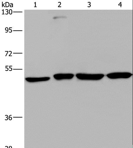 CCR6 Antibody