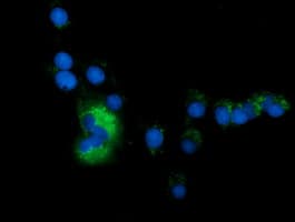 SQSTM1 Antibody (clone OTI7F6)