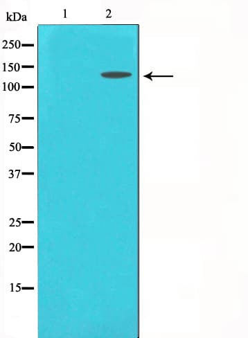 MCM2 Antibody