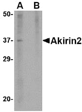 AKIRIN2 Antibody