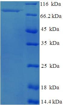Human PLAT / TPA Protein (Recombinant His-SUMO)