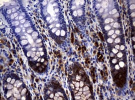 NME1 / NM23 Antibody (clone OTI2H10)
