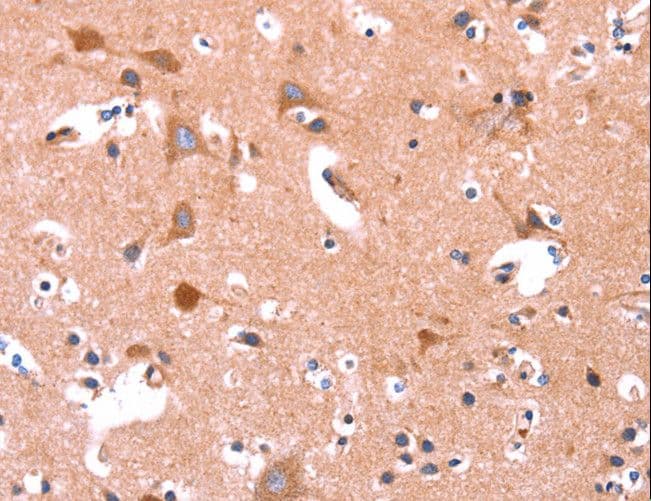 ABI1 / SSH3BP1 Antibody