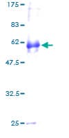 Human NDFIP2 Protein (Recombinant GST)