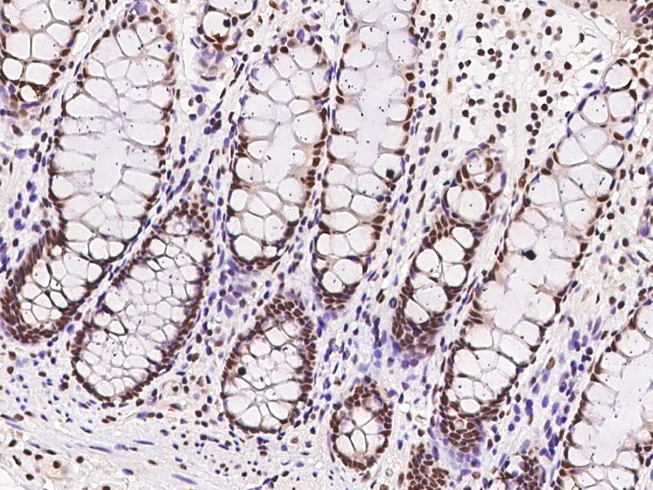 Polyclonal Rabbit anti-Human HDGFRP2 Antibody (IHC, IF)