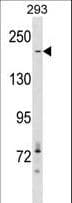 Acetyl-CoA Carboxylase / ACC Antibody (aa2010-2039)
