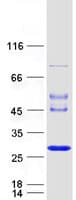 Human JOSD1 Protein (Recombinant Myc-DDK (Flag))