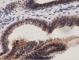 PRKD2 / PKD2 Antibody (clone OTI5G1)