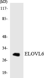 Polyclonal Rabbit anti-Human ELOVL6 Antibody (aa13-62, WB)