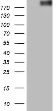 ROS1 / ROS Antibody (aa2126-2347, clone OTI1F3)