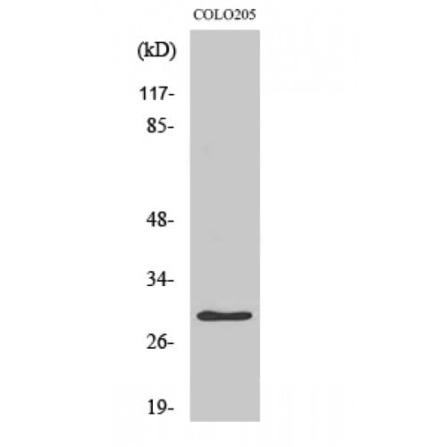 PGLS / 6PGL Antibody (160-240 aa, C-terminal)