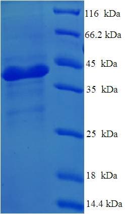 Human Complement C1QA Protein (Recombinant His-SUMO)