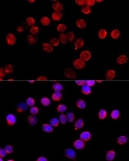CYP11B2 / Aldosterone Synthase Antibody