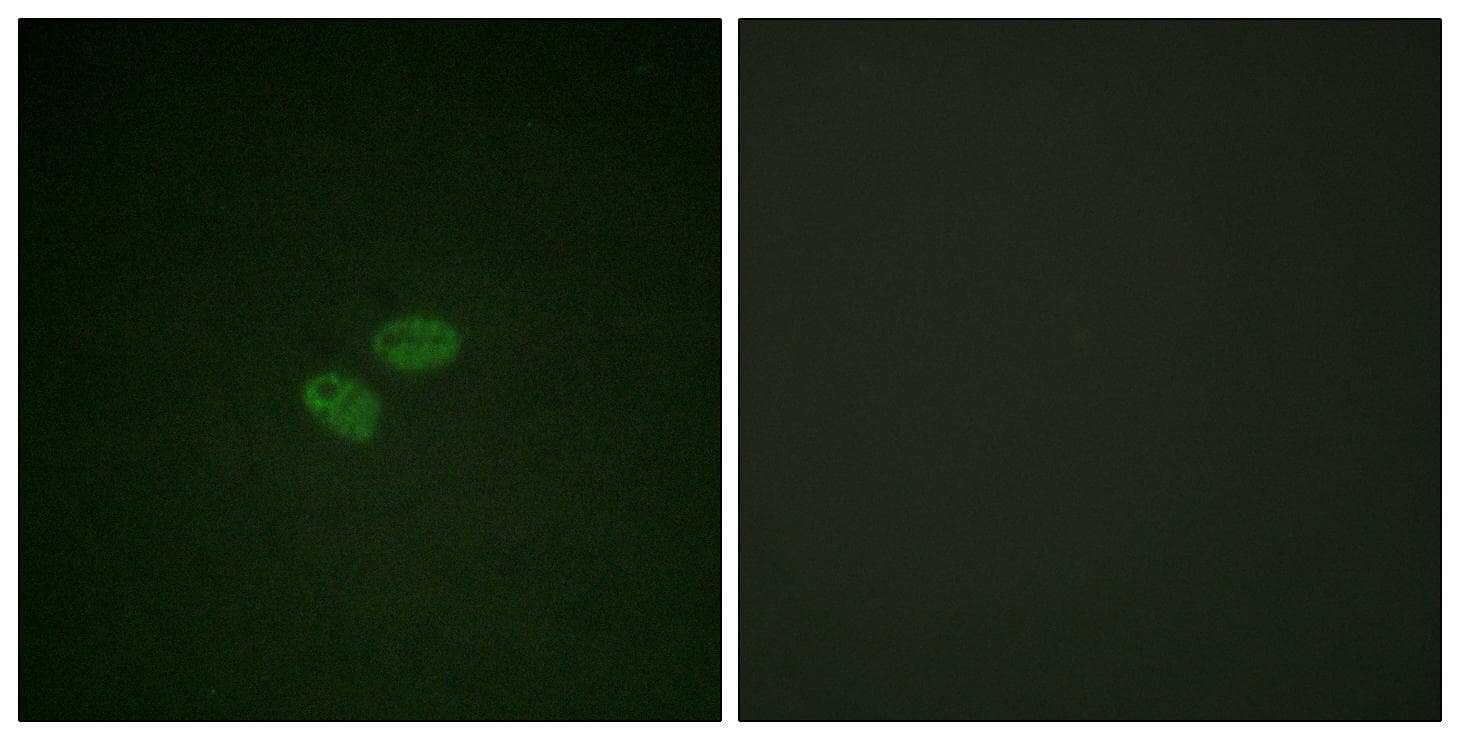 APC6 / CDC16 Antibody (p560)