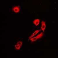 GLNRS / QARS Antibody