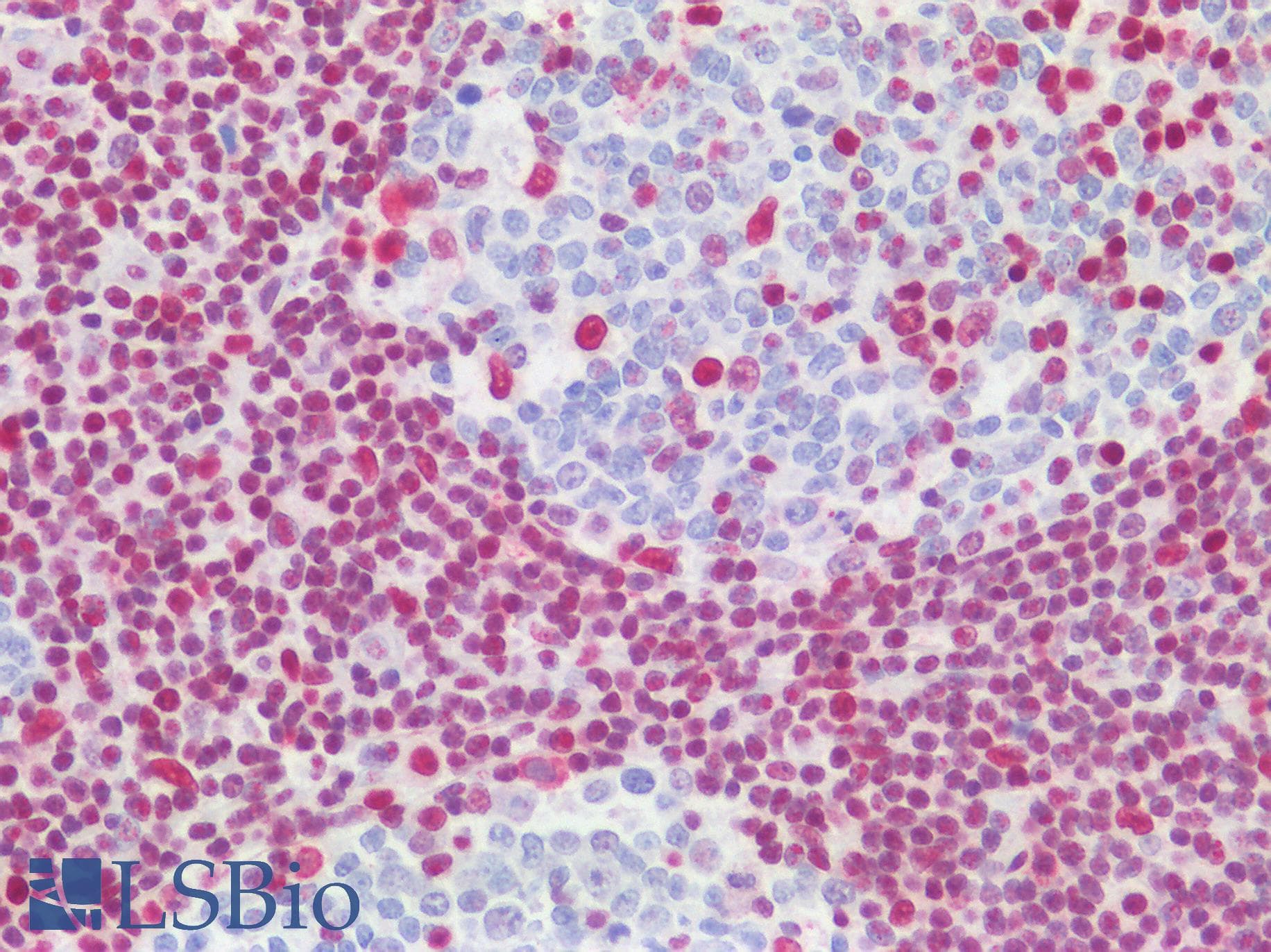 IHC-plus™ SUB1 Antibody (aa77-127)
