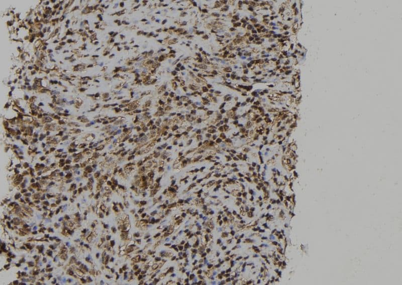 Polyclonal Rabbit anti-Human PTPN23 / HDPTP Antibody (IHC, IF, WB)