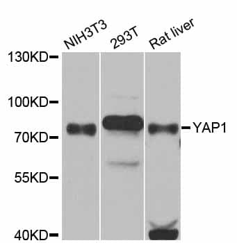 YAP / YAP1 Antibody (AP)
