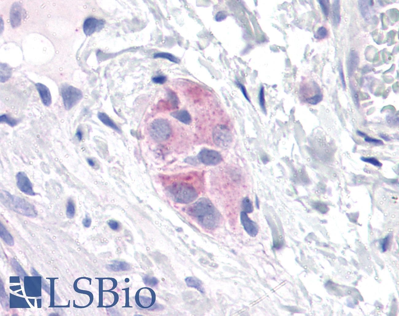 IHC-plus™ DCLK2 / DCAMKL2 Antibody