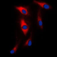 IHC-plus™ MAST205 / MAST2 Antibody (Internal)