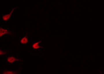 NFKB2 Antibody (phospho-Ser865)