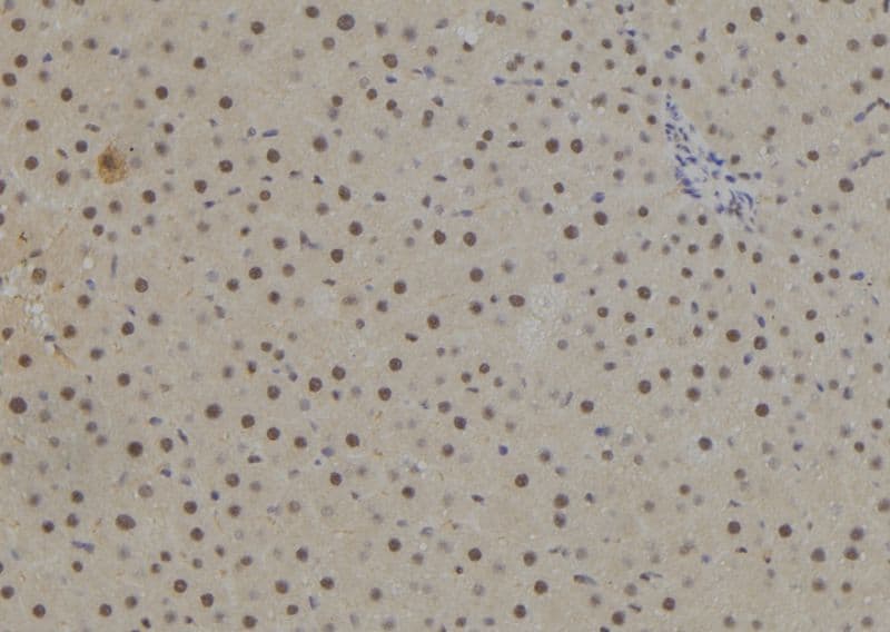 NR2E1 / TLX Antibody