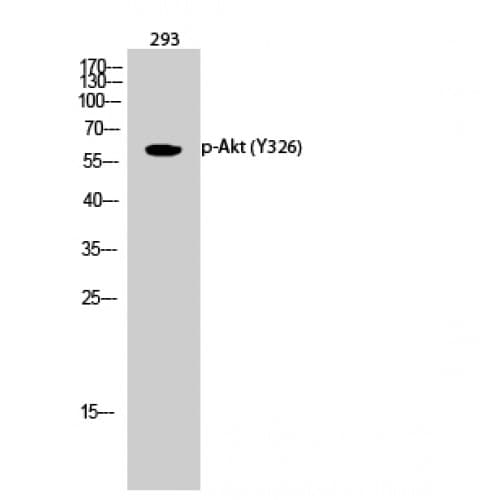 Polyclonal Rabbit anti-Human AKT1 Antibody (270-350 aa, WB)
