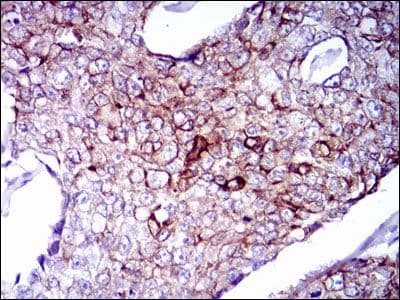 KRT5 / CK5 / Cytokeratin 5 Antibody (clone 2C2)