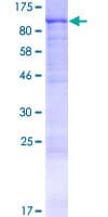 Human CCDC37 Protein (Recombinant GST)