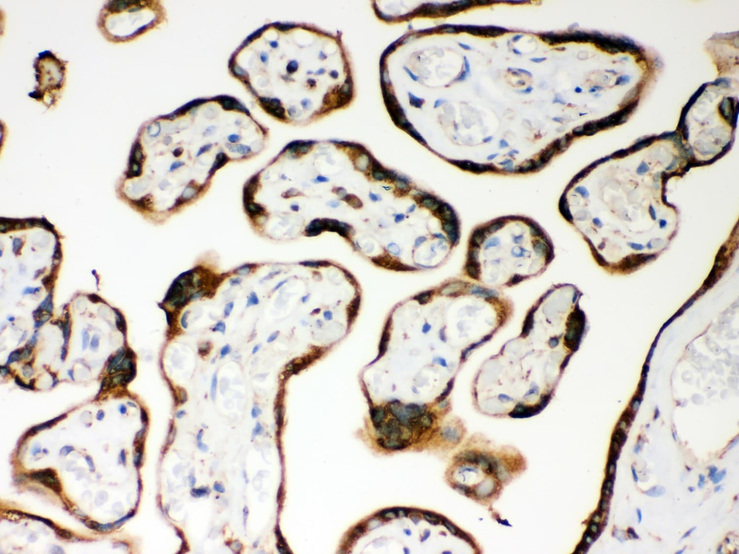 NOD1 Antibody (aa1-160)