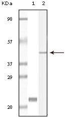 CIB1 / KIP Antibody (clone 5A1F5E12, 5A1H7E12)