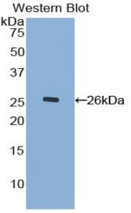 MUC17 Antibody (aa3773-3998)
