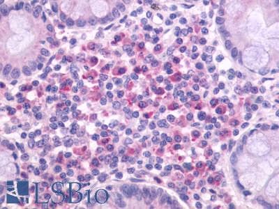 PathPlus™ Polyclonal Rabbit anti-Human ADGRE5 / CD97 Antibody (Cytoplasmic Domain, IHC)