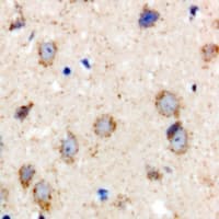 BCS1L Antibody