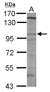 DLGAP2 Antibody