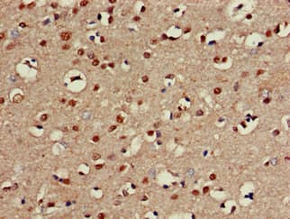 CHST1 Antibody