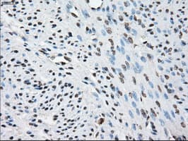 PPP5C Antibody (clone OTI1G2)