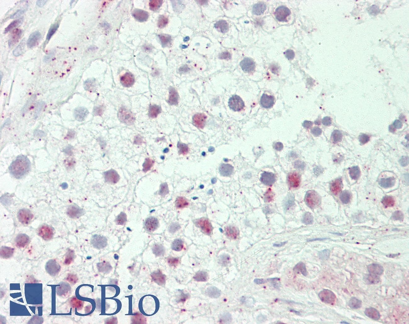 IHC-plus™ Polyclonal Rabbit anti-Human HEPHL1 Antibody (aa199-225, IHC, WB)