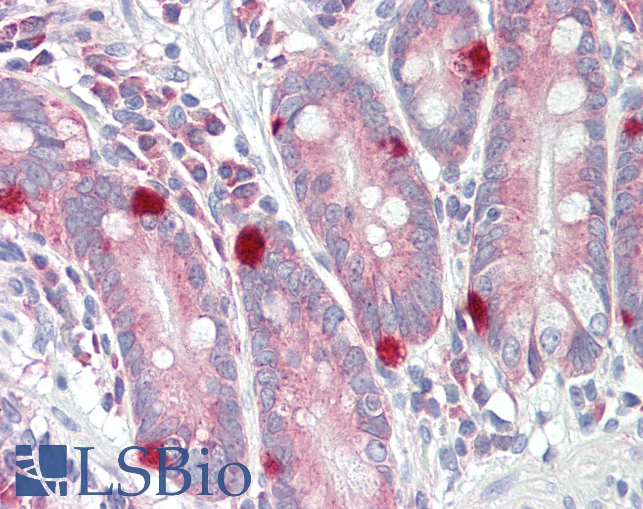 IHC-plus™ TRERF1 Antibody (aa1071-1120)