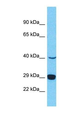 Polyclonal Rabbit anti-Human PRSS37 Antibody (N-Terminus, WB)