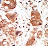PIM1 / Pim-1 Antibody (aa374-404)