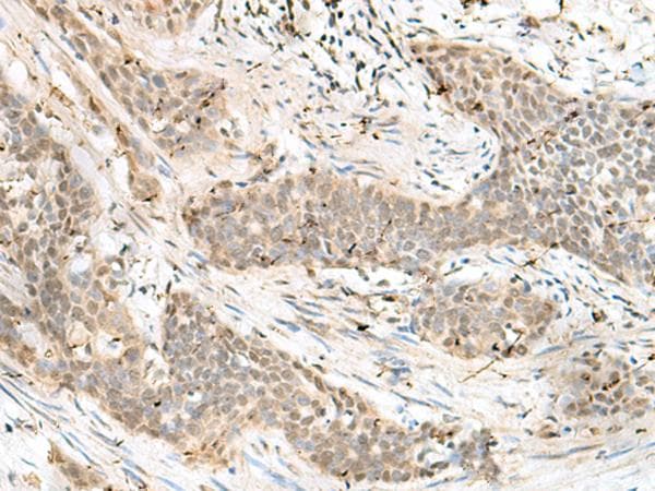 LIG4 / DNA Ligase IV Antibody