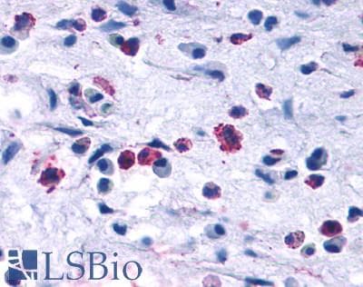 PathPlus™ CCR3 Antibody (Extracellular Domain)