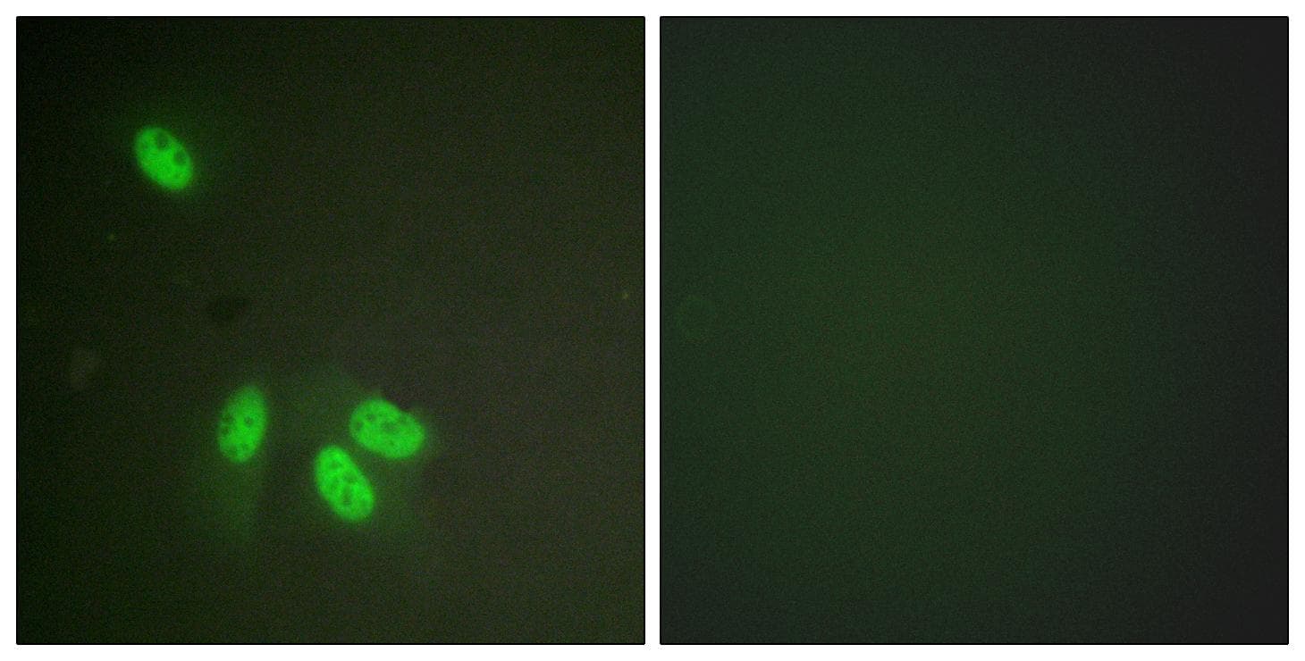 HNRNPD / AUF1 Antibody (p83)